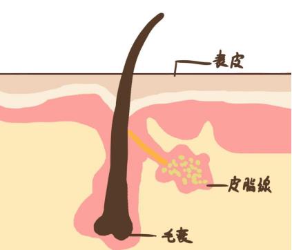 去除黑头小妙招？这些小tips一定要收藏